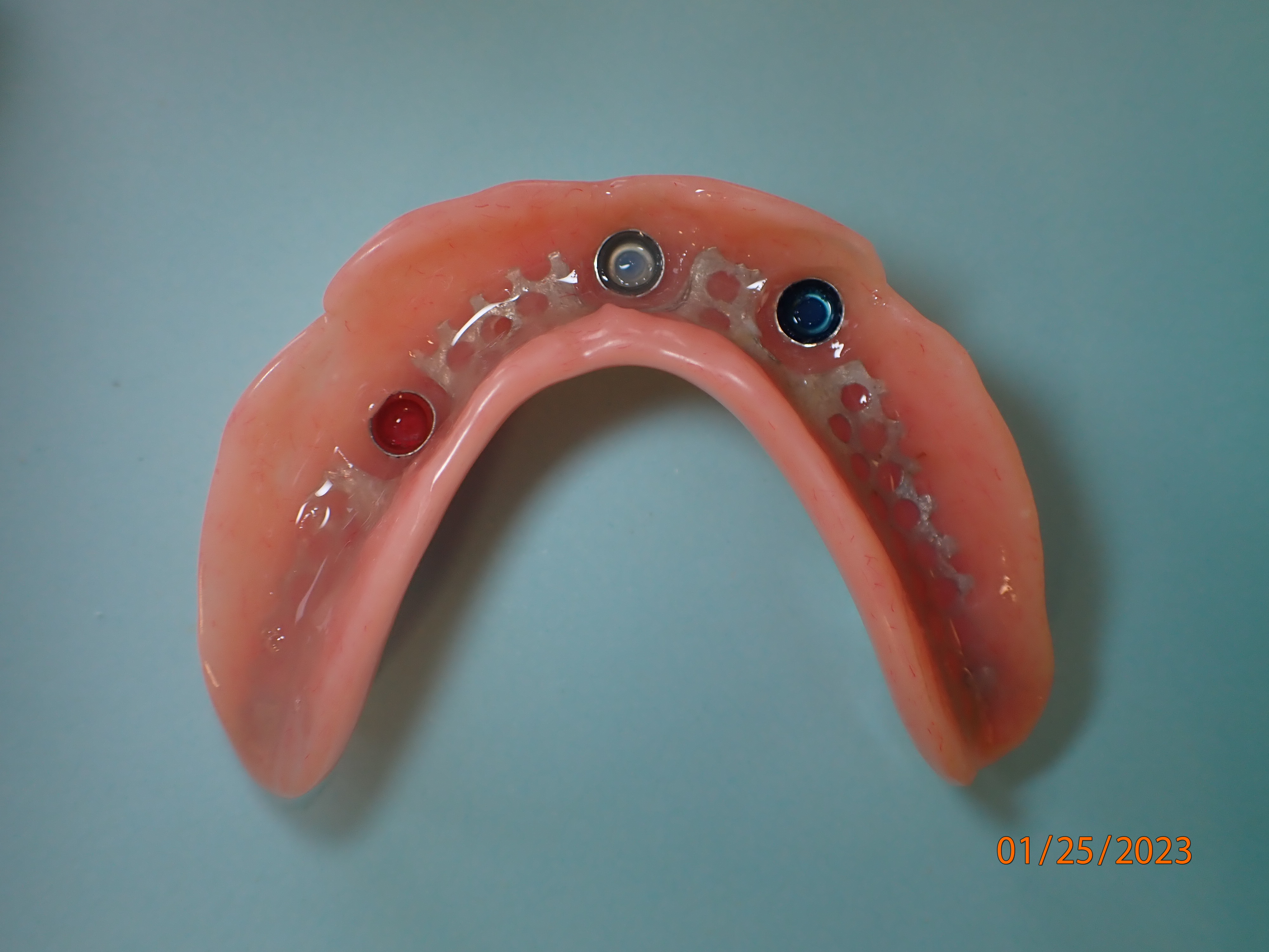 Implant denture sitting on blue surface