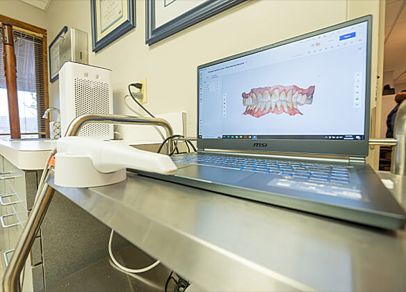 digital oral scanner