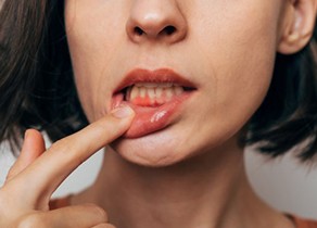 Signs & Symptoms of Oral Cancer H3)