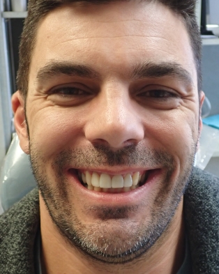 Female patient showing smile after treatment