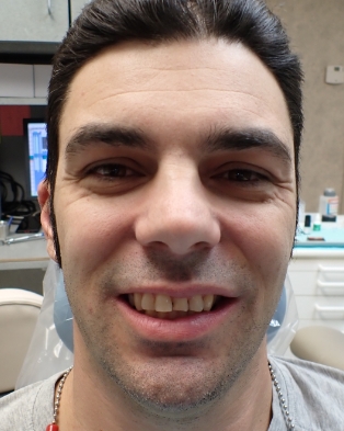 Female patient showing smile before treatment