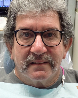Female patient showing smile before treatment