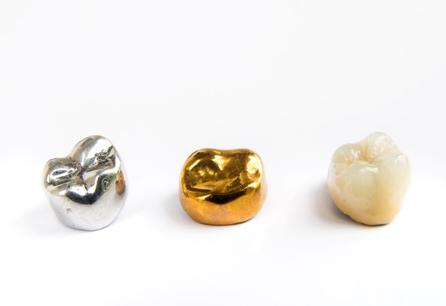 Three dental crowns made of different materials